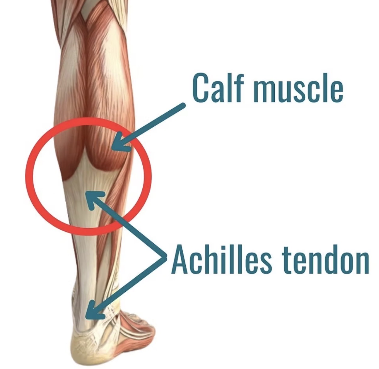 Anatomical diagram of the calf muscle and Achilles tendon